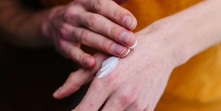 14020330000565 Test PhotoN