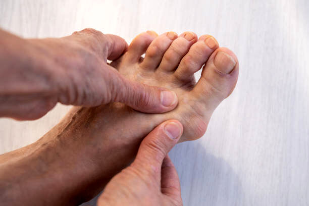 انگشت شست پای کج چیست ؟ ؛ عواملی که آن را تشدید می‌کند | چرا انگشت شست پا کج می‌شود
