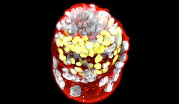 از اثبات ریاضیاتی جدید توسط دو دختر دانش آموز دبیرستانی تا امید به خوردن آسوده کیک با مصرف داروی ویگووی؛ ده رخداد از مهم‌ترین رخداد‌های علمی سال ۲۰۲۳
