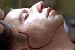 تغییر چهره با ۲۴ میلیون دلار!/ ویدئو