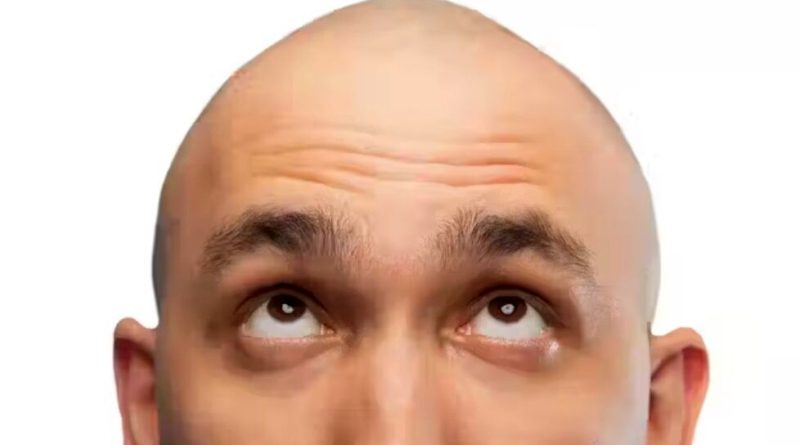 دیگر کسی در آینده تاس نمی‌شود/ دانشمندان در یک قدمی درمان