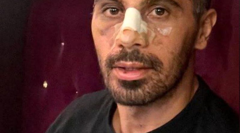 عکس| امید عالیشاه