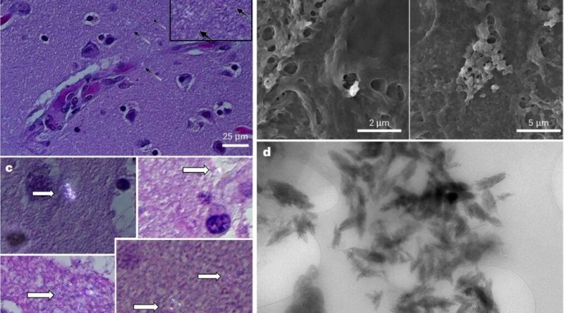 نانوپلاستیک در مغز
