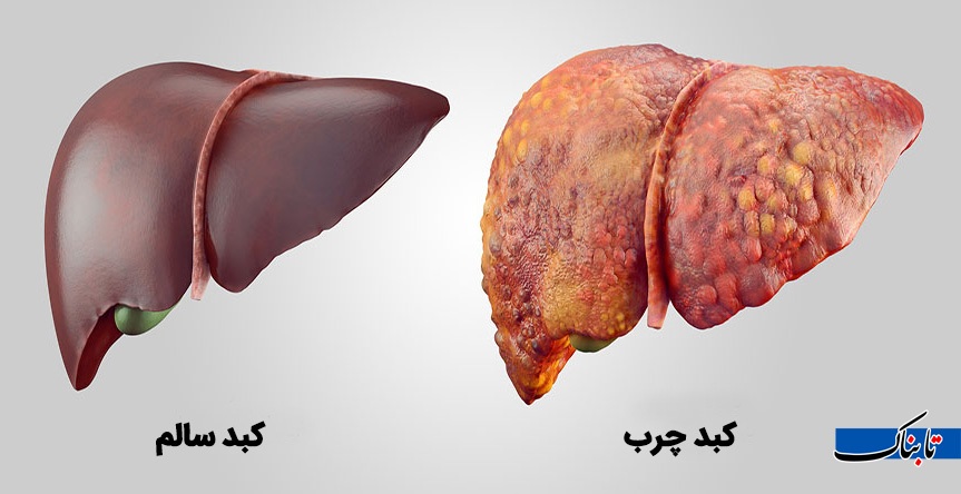 هزینه رژیم سالم در سال ۱۴۰۴ چه مقدار است؟_صبح سریع 2 رژیم غذایی لاکژری شده و مردم بر خلاف گذشته انگیزه کاهش وزن ندارند / هزینه رژیم غذایی سالم در سال ۱۴۰۴ چقدر است؟