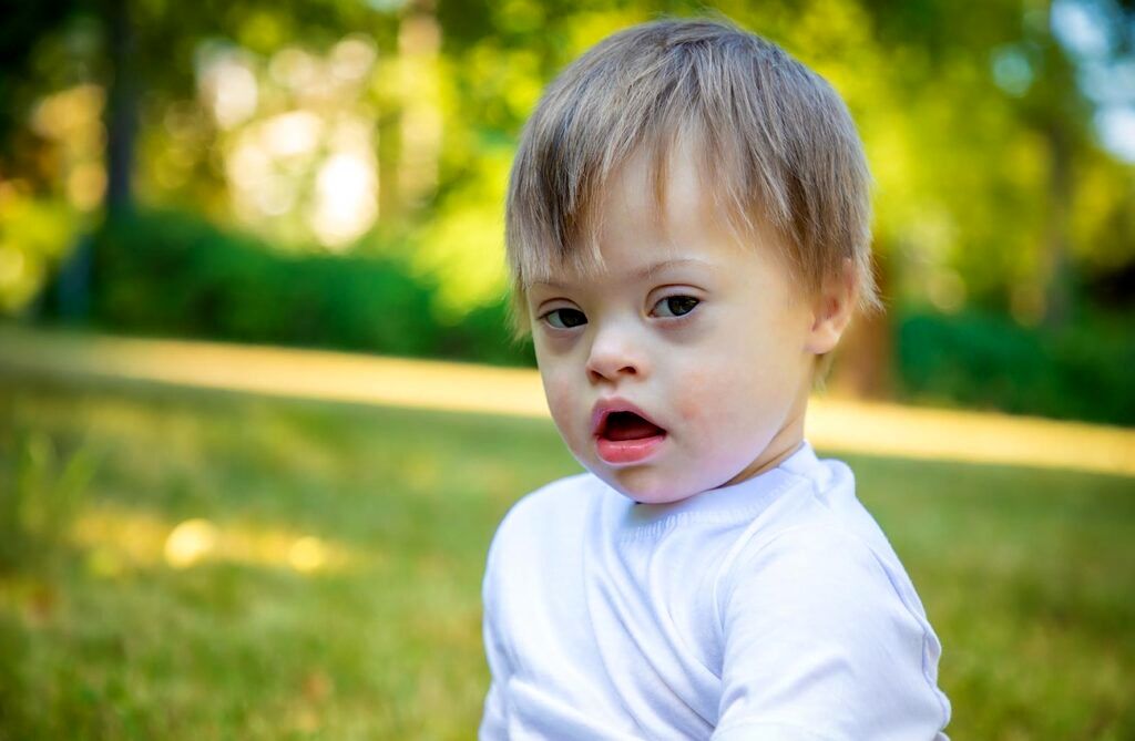 دستاورد تازه دانشمندان ژاپنی/ حذف کروموزوم عامل سندرم داون از سلولهای انسانی_صبح سریع 4 سندرم داون