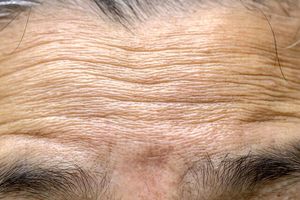 علت چروک شدن پوست با افزایش سن کشف شد