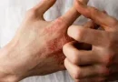 درمان های خانگی برای رفع خشکی پوست